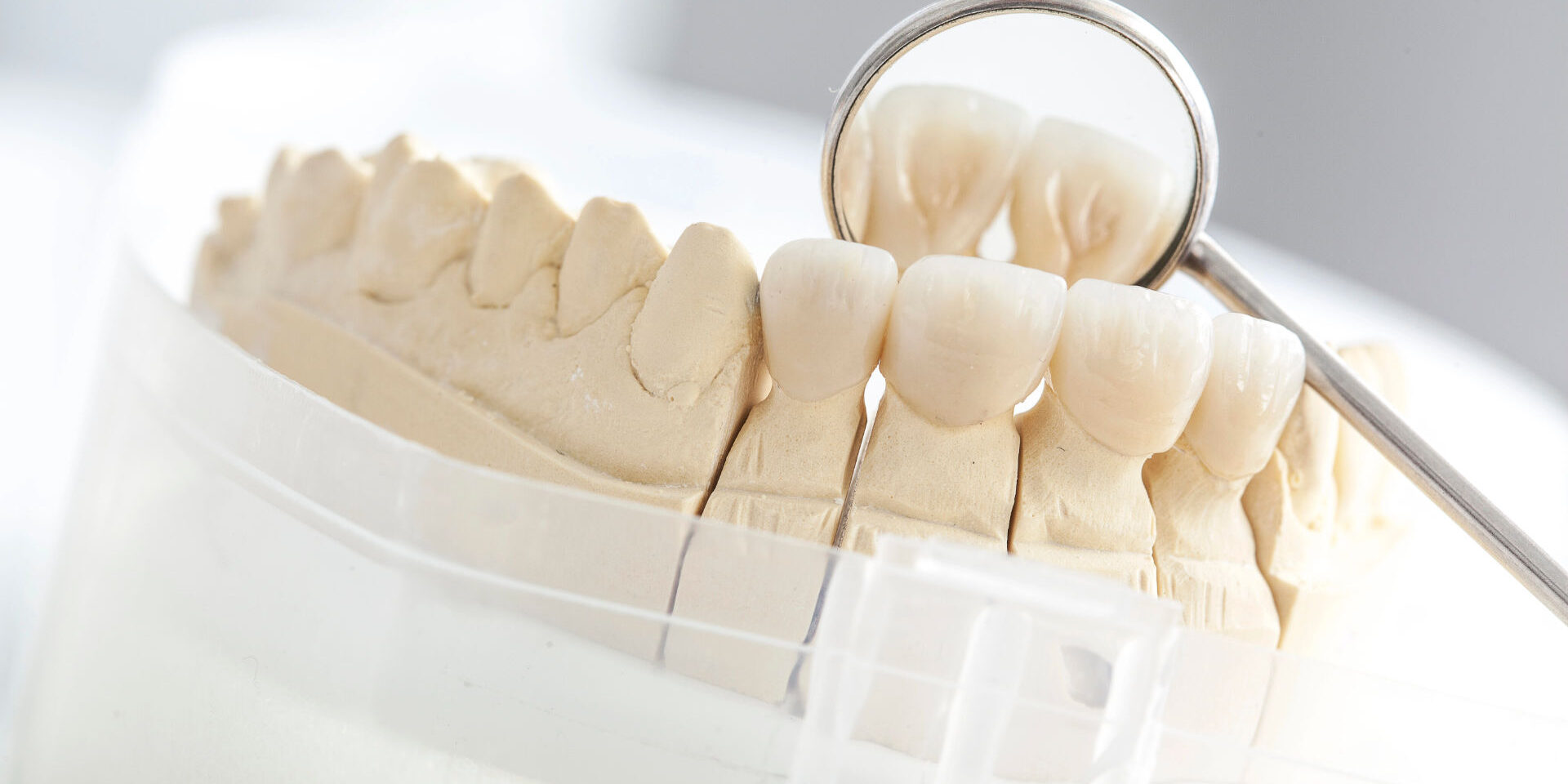 Closeup Modell eine Unterkiefers mit Keramikbrücke und Mundspiegel